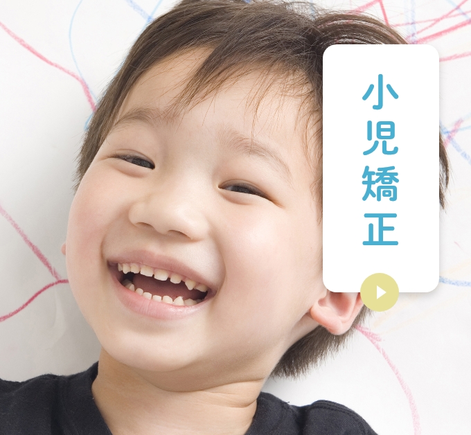 小児矯正
